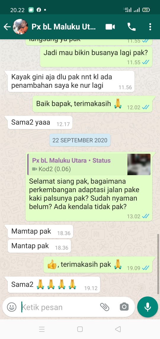 Testimoni Produk Kaki Palsu