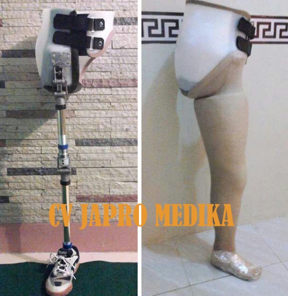 Kaki Palsu Tepat Hip