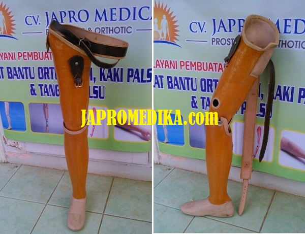 Kaki Palsu Atas Lutut Standar